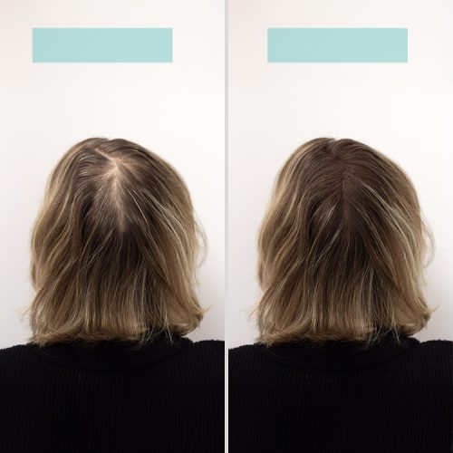 TCR Keratin Fiber - 2in1 hajépítő keratin szál és hajdúsító por - light brown/világos barna 25g