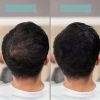 TCR Keratin Fiber - 2in1 hajépítő keratin szál és hajdúsító por - white/fehér 2,5g