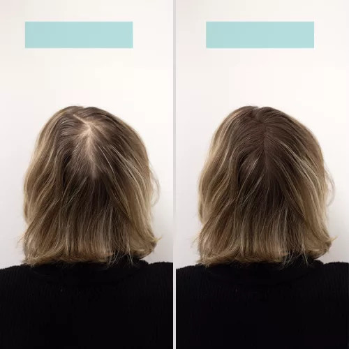 TCR Keratin Fiber - 2in1 hajépítő keratin szál és hajdúsító por - grey/szürke 2,5g