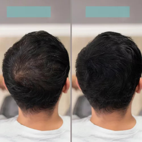 TCR Keratin Fiber - 2in1 hajépítő keratin szál és hajdúsító por - white/fehér 25g