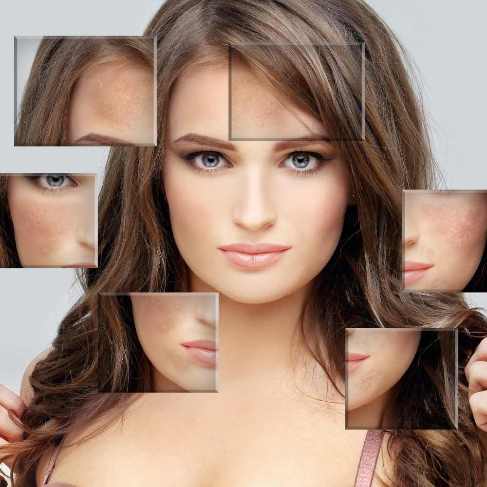 Azt hitted, télen nincs nap? – Ezért jelennek meg a sötét foltok az arcodon februárban